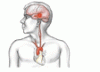 A young man with acute weakness of his right arm