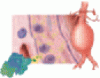 Managing abdominal aortic aneurysms Treat the aneurysm <em>and</em> the risk factors