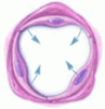 Treating pulmonary arterial hypertension: Cautious hope in a deadly disease