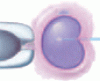 In vitro fertilization update