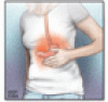 Functional dyspepsia: How to manage the burn and the bloat